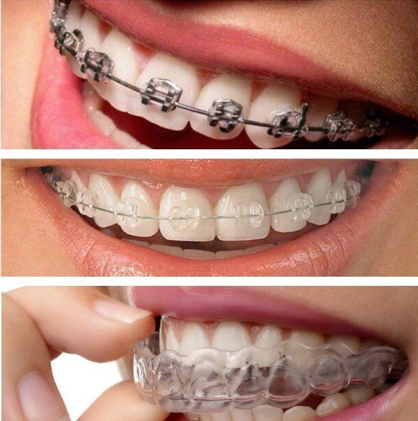Dental implant treatment