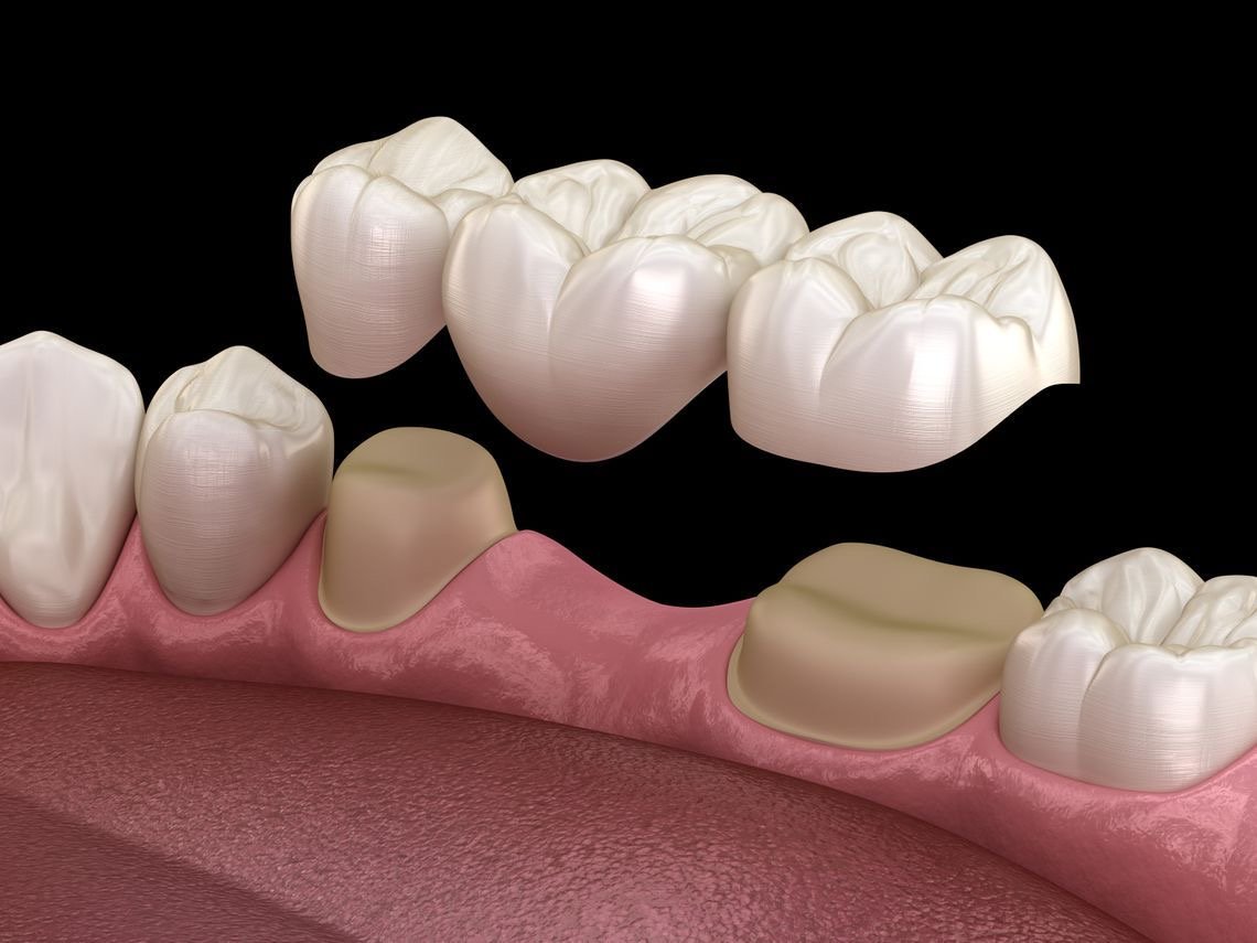 Gum care treatment