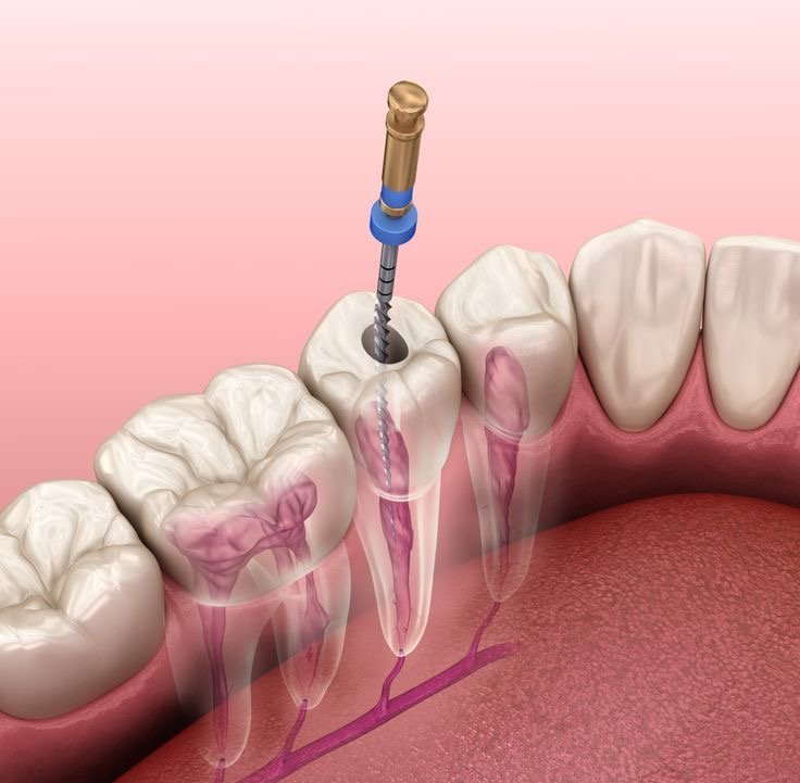 General dentistry treatment